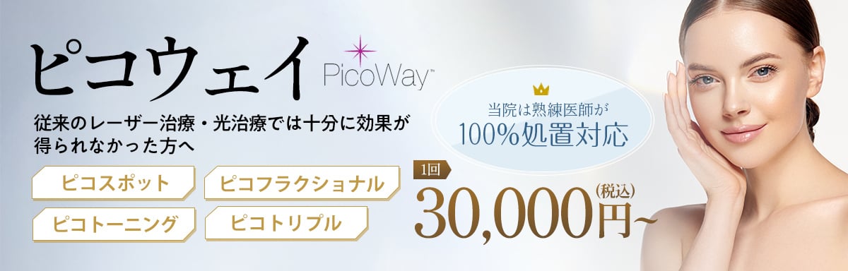 ピコウェイ